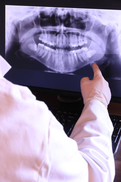 Best Emergency Tooth Extraction in Wona Lake, IN
