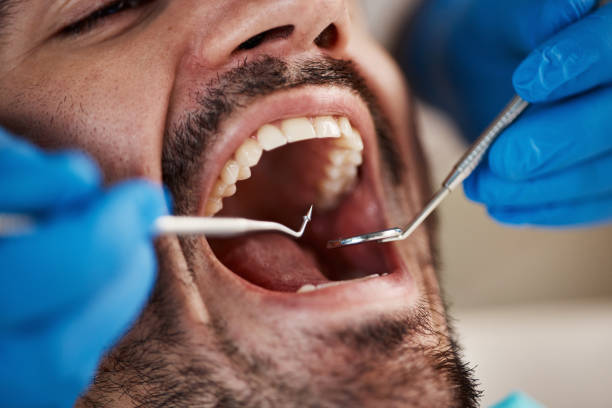 Best Walk-In Emergency Dentist in Wona Lake, IN