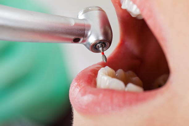 Best Emergency Broken Tooth Repair in Wona Lake, IN